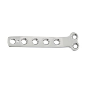 Partial Carpal Arthrodesis Plates